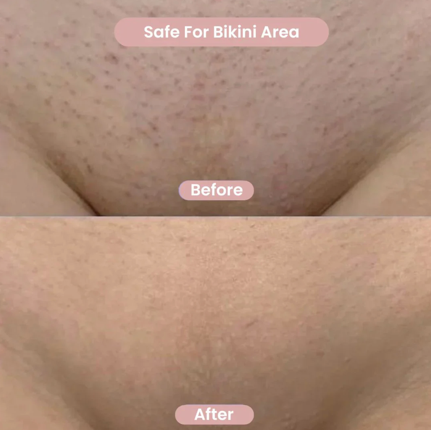 2‑in‑1 Bikini & Body Trimmer