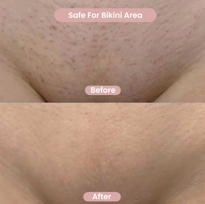 2‑in‑1 Bikini & Body Trimmer