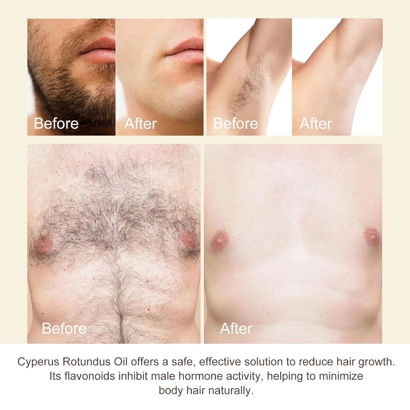 Cyperus Rotundus Oil for Hair Removal