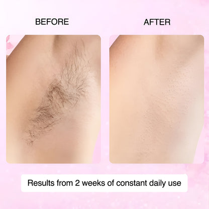 Cyperus Rotundus Oil for Hair Removal